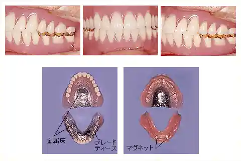 福岡で入れ歯・特殊義歯なら福岡県太宰府市のよしむら歯科医院